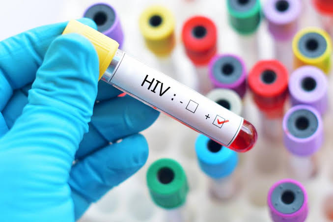 दक्षिण एशिया के इस देश में हैं सबसे ज्यादा एचआईवी संक्रमित बच्चे 1