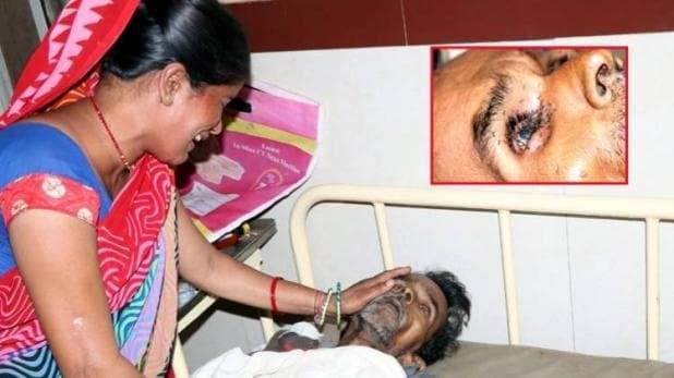 Negligence of madhya pradesh hospital : शर्मनाक ! अस्पताल में मरीज के शव पर चढ़ी चीटियां, 5 घंटों तक प्रशासन रहा बेखबर
