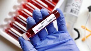 Madhya pradesh corona virus news